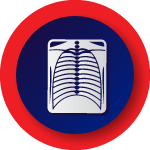 Chest Diseases Department
